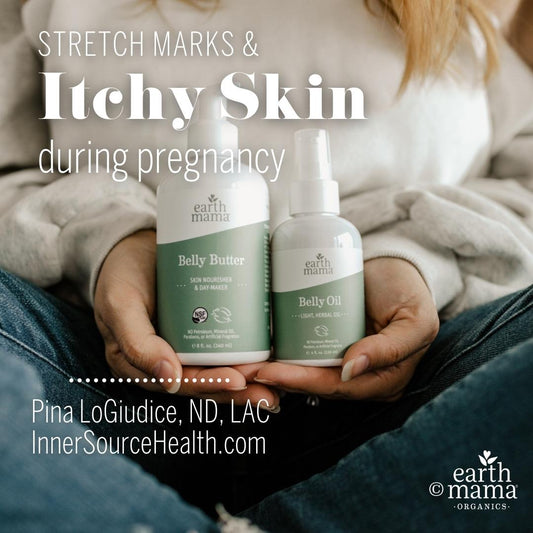 Stretch Marks And Itchy Skin During Pregnancy