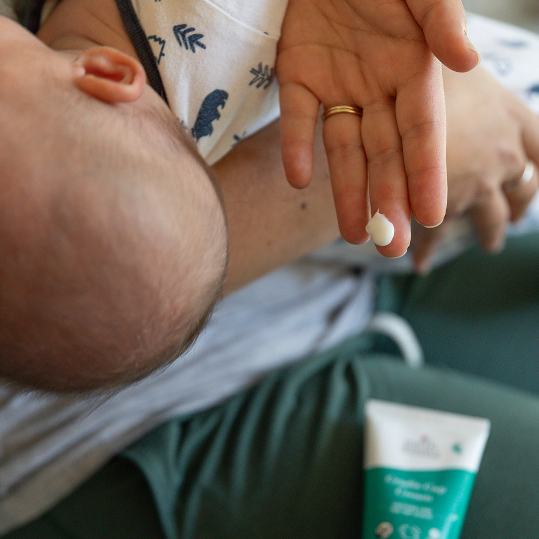 Cradle Cap Cream